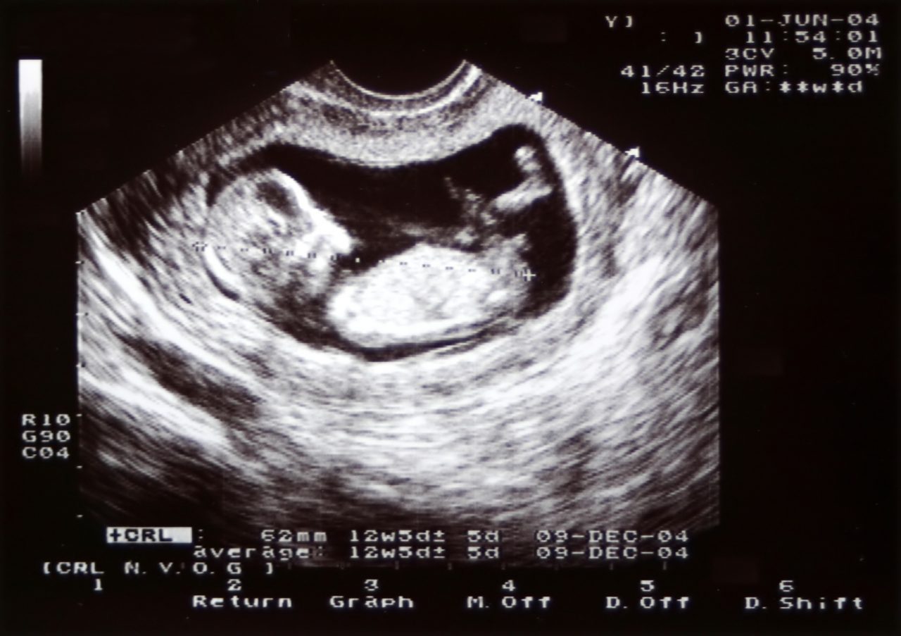 Your Experience Image Clear Ultrasound